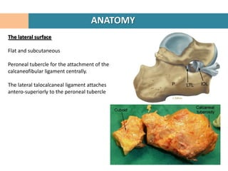 ANATOMY
The lateral surface

Flat and subcutaneous

Peroneal tubercle for the attachment of the
calcaneofibular ligament centrally.

The lateral talocalcaneal ligament attaches
antero-superiorly to the peroneal tubercle
 