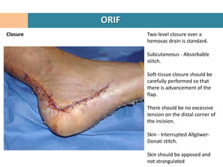 ORIF
Closure          Two-level closure over a
                 hemovac drain is standard.

                 Subcutaneous - Absorbable
                 stitch.

                 Soft-tissue closure should be
                 carefully performed so that
                 there is advancement of the
                 flap.

                 There should be no excessive
                 tension on the distal corner of
                 the incision.

                 Skin - Interrupted Allgöwer-
                 Donati stitch.

                 Skin should be apposed and
                 not strangulated
 
