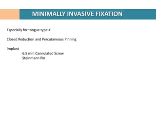 MINIMALLY INVASIVE FIXATION

Especially for tongue type #

Closed Reduction and Percutaneous Pinning

Implant
          6.5 mm Cannulated Screw
          Steinmann Pin
 