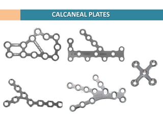 CALCANEAL PLATES
 