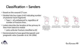 Sanders Classification Hand Descriptive Approach to and Management of calcaneal fractures.pptx