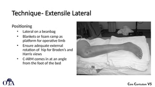 Approach to and Management of calcaneal fractures.pptx
