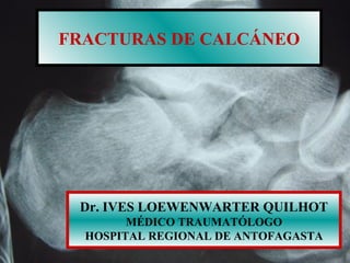 FRACTURAS DE CALCÁNEO Dr. IVES LOEWENWARTER QUILHOT MÉDICO TRAUMATÓLOGO HOSPITAL REGIONAL DE ANTOFAGASTA 