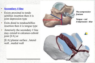● Secondary # line
● Exists proximal to tendo
achillies insertion then it is
joint depression type
● Exits distal to tendoachillies
insertion then it is tongue type
● Anteriorly the secondary # line
may extend to calcaneo-cuboid
joint [I/A] or
[E/A] plantar surface , lateral
wall , medial wall
 