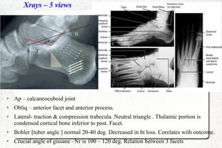Xrays – 5 views
● Ap – calcaneocuboid joint
● Obliq – anterior facet and anterior process.
● Lateral- traction & compression trabecula. Neutral triangle . Thalamic portion is
condensed cortical bone inferior to post. Facet.
● Bohler [tuber angle ] normal 20-40 deg. Decreased in ht loss. Corelates with outcome.
● Crucial angle of gissane –Nr is 100 – 120 deg. Relation between 3 facets
 