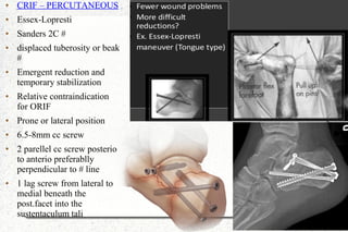 ● CRIF – PERCUTANEOUS
● Essex-Lopresti
● Sanders 2C #
● displaced tuberosity or beak
#
● Emergent reduction and
temporary stabilization
● Relative contraindication
for ORIF
● Prone or lateral position
● 6.5-8mm cc screw
● 2 parellel cc screw posterio
to anterio preferablly
perpendicular to # line
● 1 lag screw from lateral to
medial beneath the
post.facet into the
sustentaculum tali
 