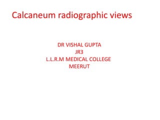 Calcaneum radiographic views
 