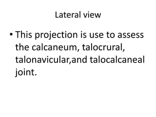 Lateral view
• This projection is use to assess
the calcaneum, talocrural,
talonavicular,and talocalcaneal
joint.
 