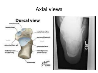 Axial views
 