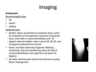 Calcaneus Fractures a brief presentation | PPTX