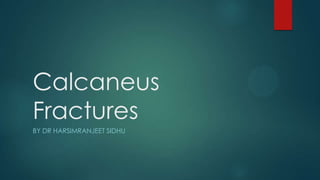 Calcaneus
Fractures
BY DR HARSIMRANJEET SIDHU

 