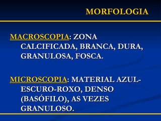 MORFOLOGIA MACROSCOPIA : ZONA CALCIFICADA, BRANCA, DURA, GRANULOSA, FOSCA. MICROSCOPIA : MATERIAL AZUL-ESCURO-ROXO, DENSO (BASÓFILO), AS VEZES GRANULOSO. 