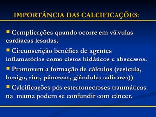 IMPORTÂNCIA DAS CALCIFICAÇÕES: Complicações quando ocorre em válvulas  cardíacas lesadas. Circunscrição benéfica de agentes inflamatórios como cistos hidáticos e abscessos. Promovem a formação de cálculos (vesícula, bexiga, rins, pâncreas, glândulas salivares)) Calcificações pós esteatonecroses traumáticas na  mama podem se confundir com câncer. 
