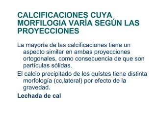 CALCIFICACIONES CUYA MORFILOGIA VARÍA SEGÚN LAS PROYECCIONES La mayoría de las calcificaciones tiene un aspecto similar en ambas proyecciones ortogonales, como consecuencia de que son partículas sólidas. El calcio precipitado de los quístes tiene distinta morfología (cc,lateral) por efecto de la gravedad. Lechada de cal 