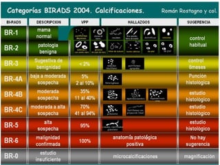 Calcificaciones mamarias - Mamografía