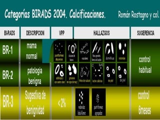 Calcificaciones mamarias - Mamografía