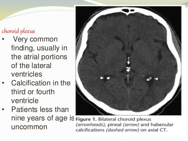 PHYSIOLOGICAL AND PATHOLOGICAL CALCIFICATION OF BRAIN