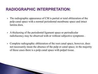  The radiographic appearance of CM is partial or total obliteration of the
pulp canal space with a normal periodontal membrane space and intact
lamina dura.
 A thickening of the periodontal ligament space or periradicular
radiolucency may be observed with or without subjective symptoms .
 Complete radiographic obliteration of the root canal space, however, does
not necessarily mean the absence of the pulp or canal space; in the majority
of these cases there is a pulp canal space with pulpal tissue.
 