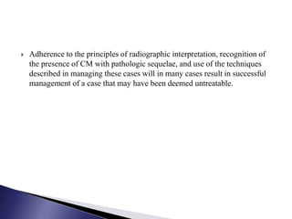  Adherence to the principles of radiographic interpretation, recognition of
the presence of CM with pathologic sequelae, and use of the techniques
described in managing these cases will in many cases result in successful
management of a case that may have been deemed untreatable.
 