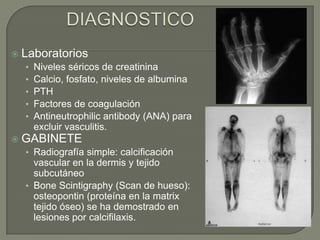 DIAGNOSTICOLaboratoriosNiveles séricos de creatininaCalcio, fosfato, niveles de albuminaPTHFactores de coagulación Antineutrophilicantibody (ANA) para excluir vasculitis.GABINETERadiografía simple: calcificación vascular en la dermis y tejido subcutáneo BoneScintigraphy (Scan de hueso): osteopontin (proteína en la matrix tejido óseo) se ha demostrado en lesiones por calcifilaxis.