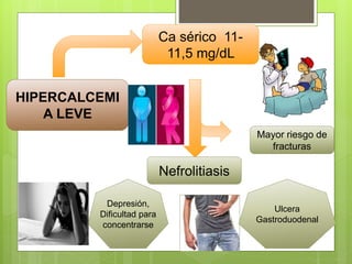 HIPERCALCEMI
A LEVE
Ca sérico 11-
11,5 mg/dL
Nefrolitiasis
Mayor riesgo de
fracturas
Depresión,
Dificultad para
concentrarse
Ulcera
Gastroduodenal
 