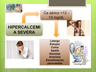 HIPERCALCEMI
A SEVERA
Ca sérico >12 -
13 mg/dL
Letargo
Estupor
Coma
Apatía
Nauseas
Anorexia
Estreñimiento
pancreatitis
 