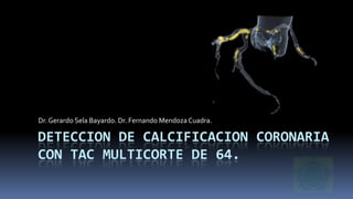 Dr. Gerardo Sela Bayardo. Dr. Fernando Mendoza Cuadra.

DETECCION DE CALCIFICACION CORONARIA
CON TAC MULTICORTE DE 64.

 