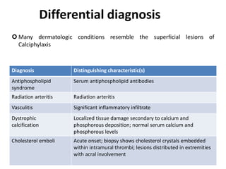 Differential diagnosis
 Many dermatologic conditions resemble the superficial lesions of
Calciphylaxis
Diagnosis Distinguishing characteristic(s)
Antiphospholipid
syndrome
Serum antiphospholipid antibodies
Radiation arteritis Radiation arteritis
Vasculitis Significant inflammatory infiltrate
Dystrophic
calcification
Localized tissue damage secondary to calcium and
phosphorous deposition; normal serum calcium and
phosphorous levels
Cholesterol emboli Acute onset; biopsy shows cholesterol crystals embedded
within intramural thrombi; lesions distributed in extremities
with acral involvement
 