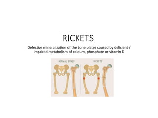 Calcium Rickets CALCIUM AND PHOSPHATE METABOLISM.pptx