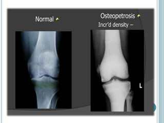 CALCIUM AND ITS CLINICAL IIMPORTANCE