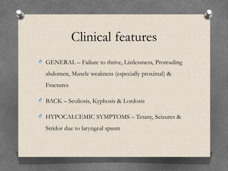 Clinical features
O GENERAL – Failure to thrive, Listlessness, Protruding
abdomen, Muscle weakness (especially proximal) &
Fractures
O BACK – Scoliosis, Kyphosis & Lordosis
O HYPOCALCEMIC SYMPTOMS – Tetany, Seizures &
Stridor due to laryngeal spasm
 