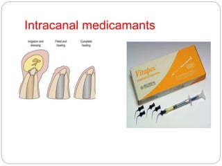 Intracanal medicamants
 