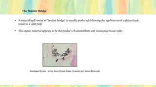 The Dentine Bridge
• A mineralized barrier or 'dentine bridge' is usually produced following the application of calcium hydr
oxide to a vital pulp.
• This repair material appears to be the product of odontoblasts and connective tissue cells.
Histological Section - Arrow Shows Dentin Bridge Formation by Calcium Hydroxide
 