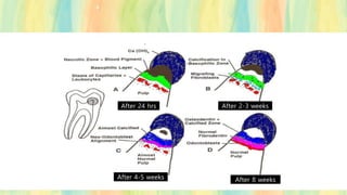 After 24 hrs
After 4-5 weeks
After 2-3 weeks
After 8 weeks
 