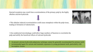Internal resorption may result from overstimulation of the primary pulp by the highly
alkaline calcium hydroxide.
• This alkaline induced overstimulation could cause metaplasia within the pulp tissue,
leading to formation of odontoclasts.
• Also undetected microleakage could allow large numbers of bacteria to overwhelm the
pulp and nullify the beneficial effects of calcium hydroxide
• At present calcium hydroxide pulpotomy technique cannot be generally recommended for primary teeth.
• recommended agent for carious and traumatic exposures in young permanent teeth, particularly with
incomplete closure.
 