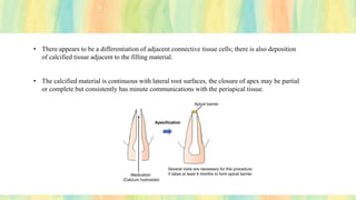 • There appears to be a differentiation of adjacent connective tissue cells; there is also deposition
of calcified tissue adjacent to the filling material.
• The calcified material is continuous with lateral root surfaces, the closure of apex may be partial
or complete but consistently has minute communications with the periapical tissue.
 