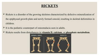 Calcium Rickets CALCIUM METABOLISM and its uses in dental | PPTX