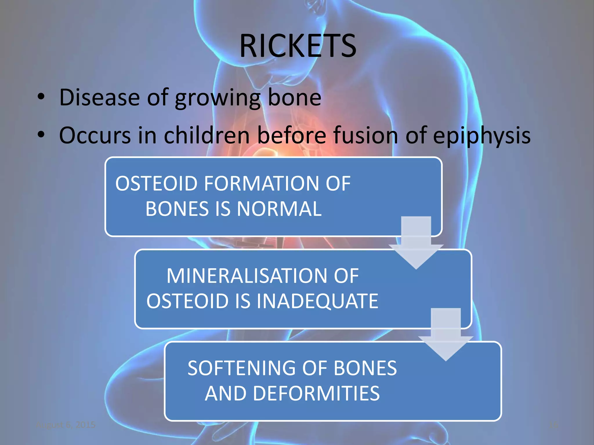 Calcium Rickets Calcium metabolism, rickets and osteomalacia | PPTX