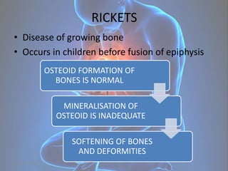 RICKETS
• Disease of growing bone
• Occurs in children before fusion of epiphysis
August 6, 2015 16
OSTEOID FORMATION OF
B...