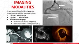 IMAGING
MODALITIES
Circulation. 2022;145:e18–e114. DOI: 10.1161/CIR.0000000000001038
A
B
Imaging modalities for identifying and
characterizing calcified coronary lesions:
• Coronary angiography
• Coronary CT angiography
• Intravascular imaging:
• Intravascular ultrasound (IVUS)
• Optical coherence tomography (OCT)
 