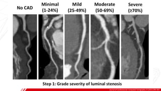 CCTA INDICATIONS
Journal of Cardiovascular Computed Tomography 15 (2021) 290–303
A
B
 