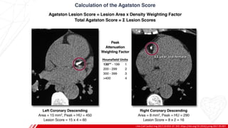 PREVALENCE
J Am Coll Cardiol Img 2017;10:923–37. DOI: https://doi.org/10.1016/j.jcmg.2017.05.007
A
B
 
