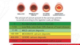 PREVALENCE
J Am Coll Cardiol Img 2017;10:923–37. DOI: https://doi.org/10.1016/j.jcmg.2017.05.007
A
B
 