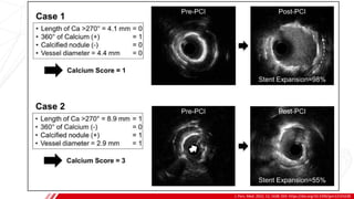J. Pers. Med. 2022, 12, 1638. DOI: https://doi.org/10.3390/jpm12101638
B
Severity Classification
 