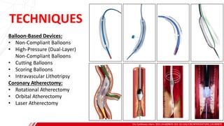 TECHNIQUES
Circ Cardiovasc Interv. 2021;14:e009870. DOI: 10.1161/CIRCINTERVENTIONS.120.009870
A
B
Balloon-Based Devices:
• Non-Compliant Balloons
• High-Pressure (Dual-Layer)
Non-Compliant Balloons
• Cutting Balloons
• Scoring Balloons
• Intravascular Lithotripsy
Coronary Atherectomy:
• Rotational Atherectomy
• Orbital Atherectomy
• Laser Atherectomy
 