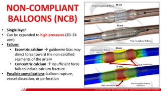 NON-COMPLIANT
BALLOONS (NCB)
Circ Cardiovasc Interv. 2021;14:e009870. DOI: 10.1161/CIRCINTERVENTIONS.120.009870
B
• Single layer
• Can be expanded to high pressures (20–24
atm)
• Failure:
• Eccentric calcium → guidewire bias may
direct force toward the non-calcified
segments of the artery
• Concentric calcium → insufficient force
fails to induce calcium fracture
• Possible complications: balloon rupture,
vessel dissection, or perforation
 