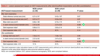 Cuculi F, et al. Open Heart 2020;7:e001204. doi:10.1136/openhrt-2019-001204
B
 
