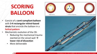SCORING
BALLOON
Circ Cardiovasc Interv. 2021;14:e009870. DOI: 10.1161/CIRCINTERVENTIONS.120.009870
B
• Consist of a semi-compliant balloon
with 3-4 rectangular nitinol-based
struts that encircle the balloon in a
helical pattern
• Mechanistic evolution of the CB:
• Reducing the mechanical trauma
exerted on the vessel wall →
lower risk of dissection
• More deliverable
 