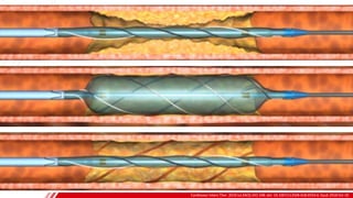Cardiovasc Interv Ther. 2019 Jul;34(3):242-248. doi: 10.1007/s12928-018-0553-6. Epub 2018 Oct 19.
B
 