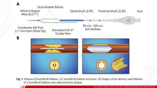 SCORING
BALLOON
Int J Cardiol. 2016 Oct 15;221:23-31. doi: 10.1016/j.ijcard.2016.07.002. Epub 2016 Jul 4.
B
 